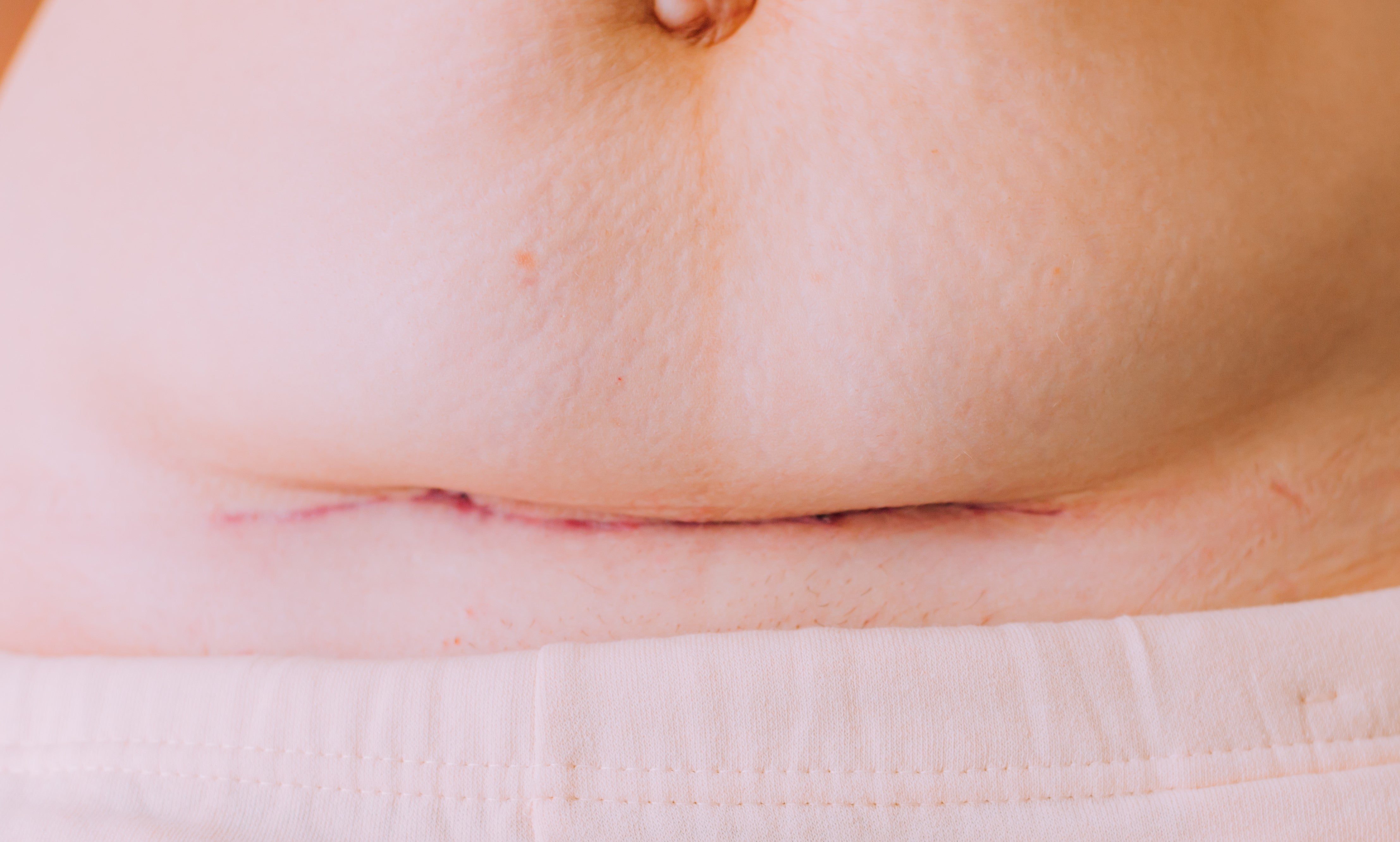 The A to Z of Healing from a C-Section
